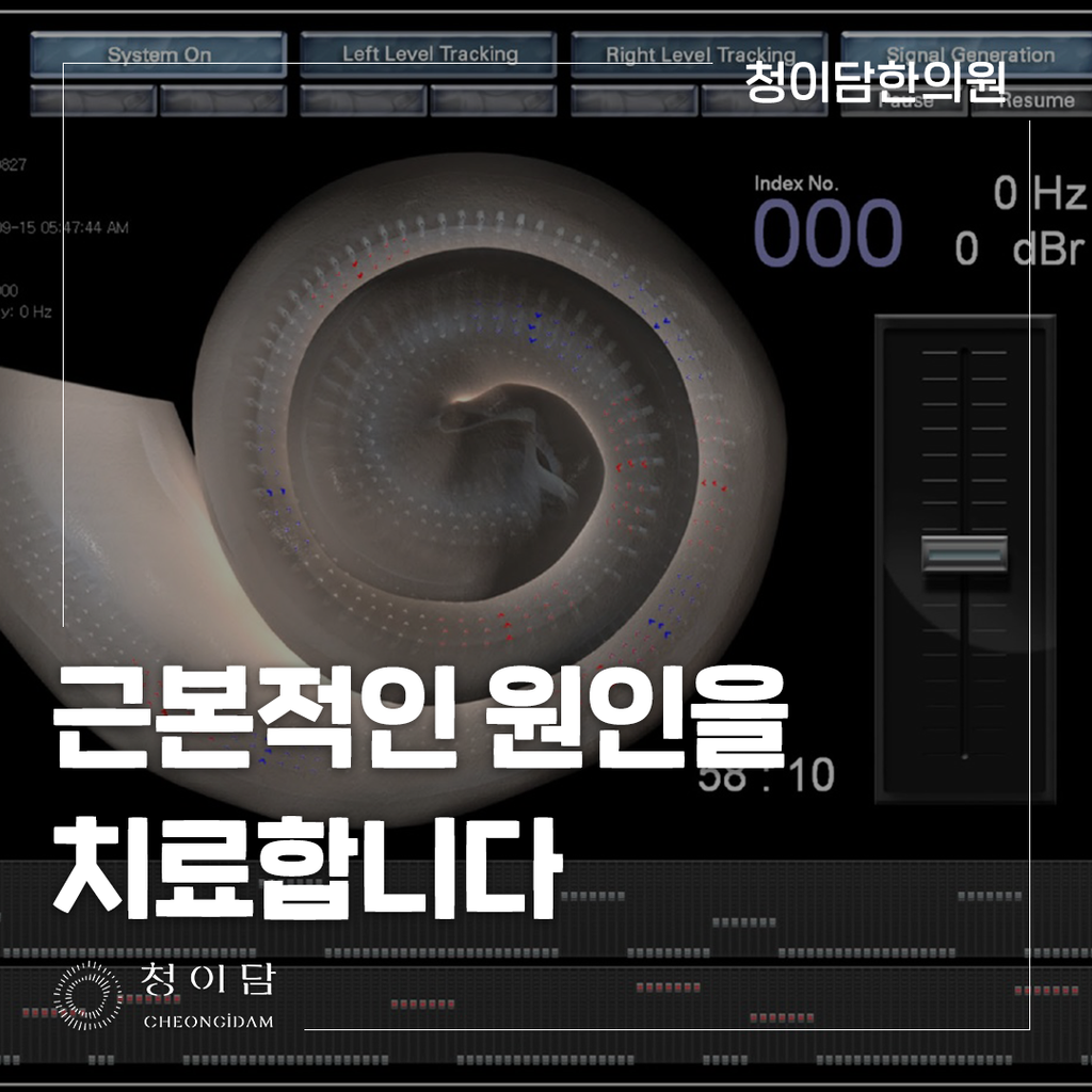 왼쪽 귀 먹먹
